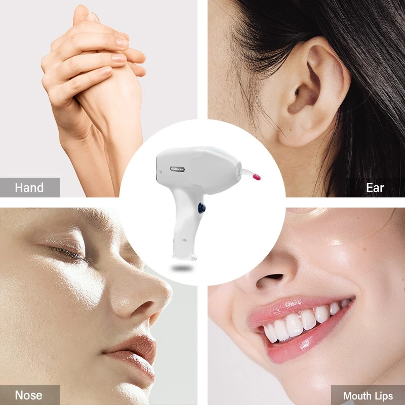 laser hair removal laser hair removal