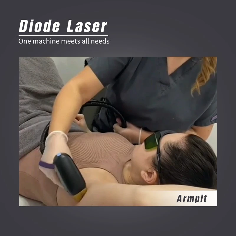 hair removal hair removal