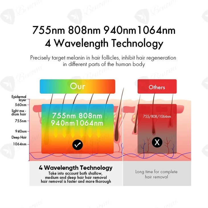 The Most Advanced 4-wavelength Diode Laser Hair Removal Machine