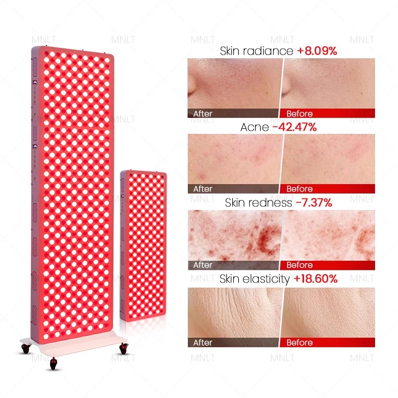 2026 Best Red Light Therapy Panels suppliers