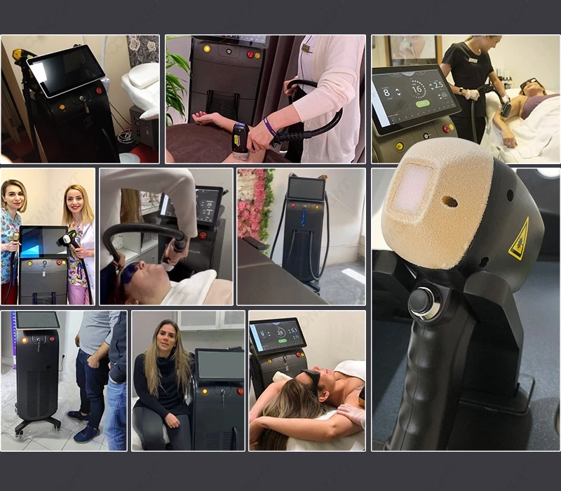 Buy Diode Laser Hair Removal Machine Price