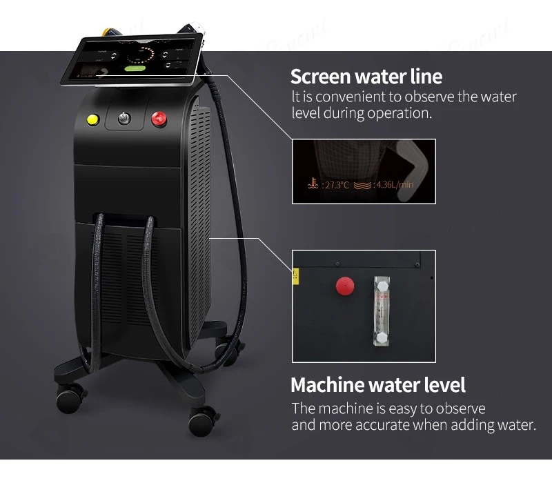 Long-Lasting Laser Technology | Laser Hair Removal Equipment